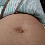 切迫早産で長期入院！ようやく８ヶ月半(３０週)になったものの、腹囲が激減！？